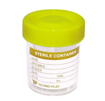 Specimen Sample Container, Urine Jar, 70ml, Sterile, with Ye